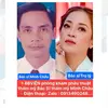 BBVIỆN P.khám thẩm mỹ BS CHÂu✅ - @bschauip6.2 - TikTok