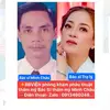 BBVIỆN P.khám thẩm mỹ BS CHÂu✅ - @bschau.ip4.1 - TikTok