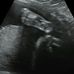 Habersham OB GYN (Dr. Thomas Hatchett - Facebook