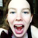Thomas Teasley - @pinwebroodf - Instagram