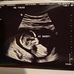 Travis Rowe - Facebook