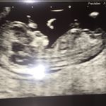 Vicky Morton - @mortonv79 - Instagram
