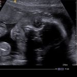 Braydyn Wayne Ramirez 💙 - @braydynramirez - Instagram
