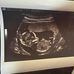 Will Frye - Facebook