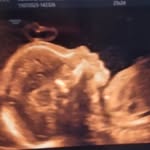 @william_andryl02 - Instagram