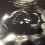 Zachary - @zachary_leonel - Instagram