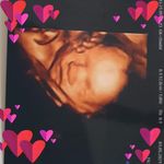 Zoe Leach - @leachzoe - Instagram
